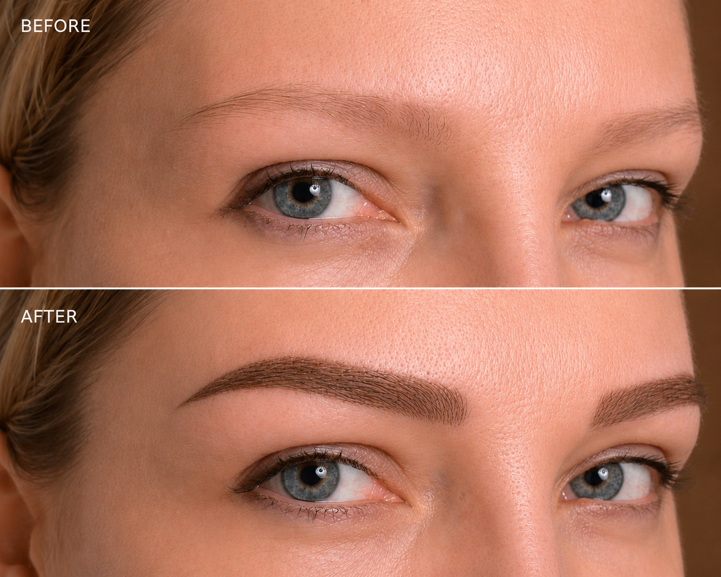 Combination brow enhancement — before and after